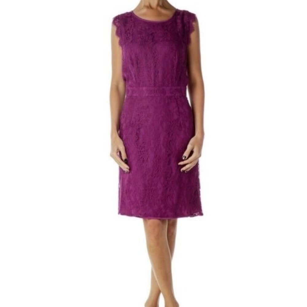 Brixon Ivy Elegant Lace Dress - medium